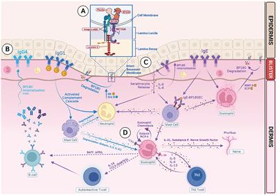 Targeting type 2 inflammation in bullous pemphigoid: current and emerging therapeutic approaches